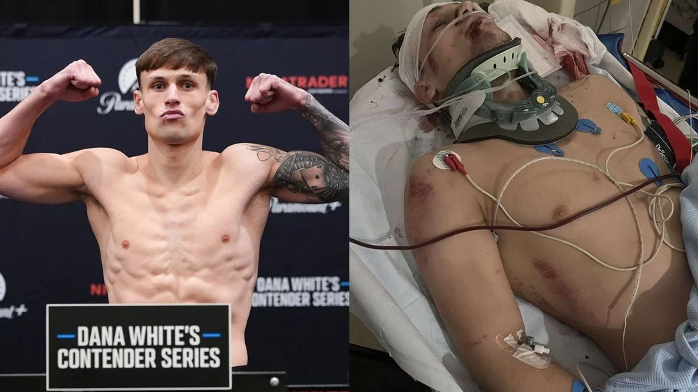 Liam McCracken selvisi onnettomuudesta ja tavoittelee UFC-sopimusta - MMA-uutinen